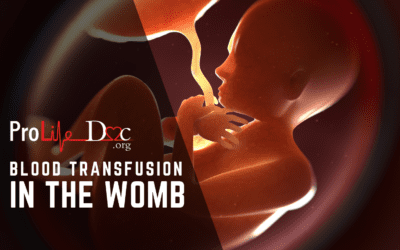 Blood Transfusions — WITHIN the Womb!