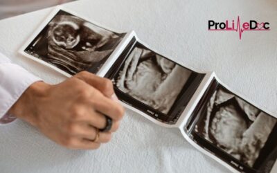 The Truth About Late-Term Abortions